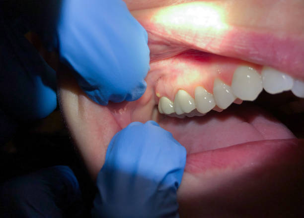 Best Mobile Emergency Dentist in Pine Ridge At Crestwood, NJ