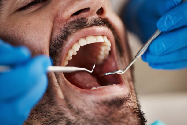 Best Broken or Cracked Tooth Emergency Dentist in Pine Ridge At Crestwood, NJ