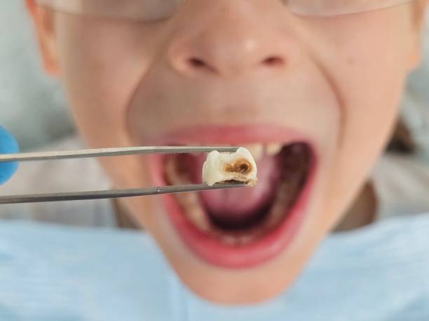 Best Emergency Dental Care for Abscessed Tooth in Pine Ridge At Crestwood, NJ