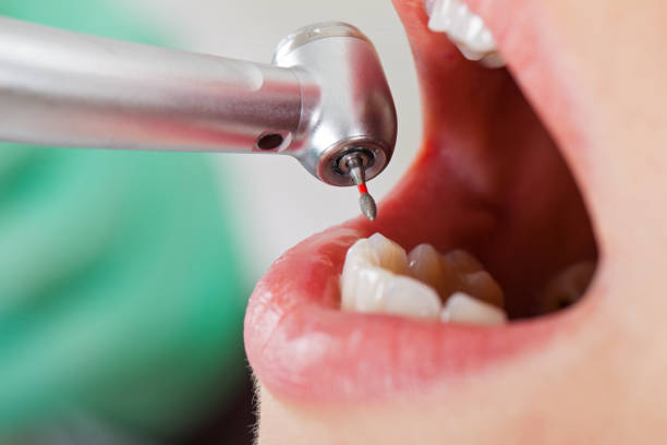 Best Emergency Dentist for Knocked-Out Tooth in Pine Ridge At Crestwood, NJ